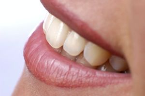 Tooth Exposure